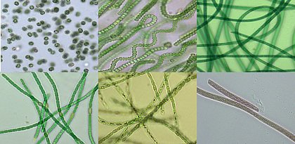 Microcystin-produzierende Cyanobakterien-Stmme